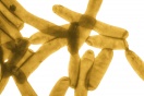 Leptospire : une bactérie qu'elle est méchante pour le triathlète !